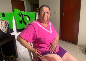 Homem em Mercedes Benz de R$ 220 mil arrasta ambulante idosa por 100 metros