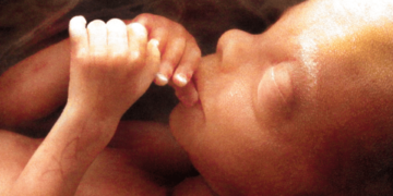 Falta equilíbrio e sobra destempero no debate de projeto contra o aborto